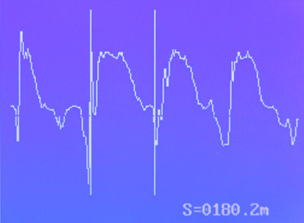 XHGG501Bæ³¢å½¢åææ¾ç¤º